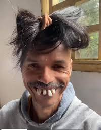 Andy Wiley just back from Turkey 🇹🇷 🦷