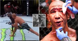 UFC's worst injuries: Gregory Rodrigues' gruesome cut is hard to look at