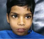 Table of Contents page: The Journal of Pediatrics