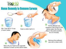 After Seeing This You Won T Ever Use Cotton Swabs For Cleaning Your Ears Again Brommando Com Cleaning Your Ears Ear Cleaning Wax Ear Cleaning