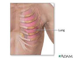 Ribs provide protection, but lung injuries can occur. Ribs And Lung Anatomy Medlineplus Medical Encyclopedia Image