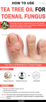 Tea tree oil is a powerful fungicide and, thus, is an effective treatment against toenail fungus. Tea Tree Oil To Treat Toenail Fungus How To Use Toenail Fungus Tea Tree Oil Uses Nail Fungus Treatment