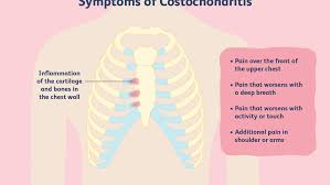 In the front, the neck extends from the bottom part of the mandible (lower jaw bone) to the bones of the upper chest and shoulders (including the sternum and collar bones). Costochondritis Overview And More