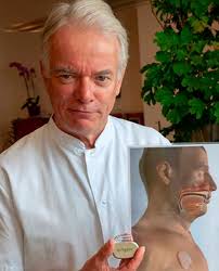 Zungenschrittmacher als weitere Therapieoption bei obstruktiver Schlafapnoe 