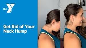 This is a rounded hunch that occurs at the base of your neck. Get Rid Of Your Neck Hump Youtube