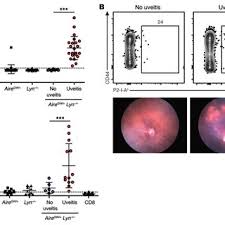 En tredje søster ligger hardt skadd på l haukeland sykehus. Pdf Lyn And Aire Mediated Tolerance Checkpoint Defects Synergize To Trigger Organ Specific Autoimmunity