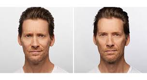 Check as with any cosmetic procedure, it's important that you find an experienced dr. Dysport Aesthetica Skin Health Center Madison Appleton Wi