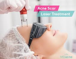 Maybe you would like to learn more about one of these? Acne Scar Laser Treatment A Dermatologist S Guide Mdacne