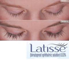 Put one drop of latisse on the top side of the applicator tip. Latisse Treatment Culver City Las Vegas