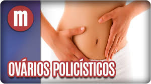 Ovarios Policisticos Mulheres 16 03 17 Youtube