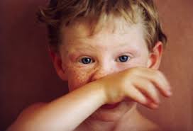 Signs Your Allergies Are Out Of Control Childrens Health Sick Kids Kids Health