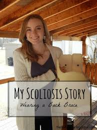 My Scoliosis Story Part 1 Wearing A Back Brace Scoliosis Scoliosis Exercises Shiatsu Massage