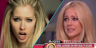 Avril Lavigne Announces First Comeback Following Illness