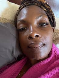 Hi everyone!! Just giving an update! I had a bone graph done