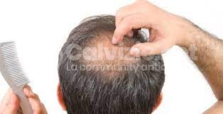 E poi non dimentichiamo che il buzzcut, il taglio rasato con la macchinetta, è stata la scelta preferita, in tempi di covid, di tante star. Come Tagliarsi I Capelli Da Solo Dal Taglio Base Al Nuovo Look Calvizie Net