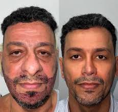 these surgeons are doing witchcraft