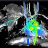 An mri exam doesn't use ionizing radiation and is. Https Encrypted Tbn0 Gstatic Com Images Q Tbn And9gcqalwtorgbmyjuz27jy1nh 2agrpukunfvup4iiqkbhmqp81hc4 Usqp Cau