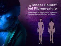 Fibromyalgie Erkennen Wenn Der Ganze Korper Schmerzt
