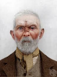 Insanely Colourised Images Depict Asylum Patients From The Victorian Era