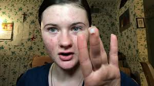 Nighttime Routine For Acne How I Apply Differin How I M Clearing My Skin Youtube