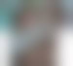 Image result for Pemphigoid