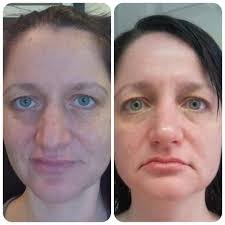 Rodan + Fields Dermatologists ~ Las Vegas, NV