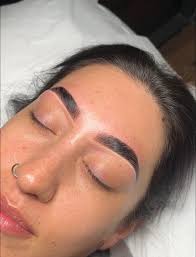 Where to get CIMT scans in the valley?