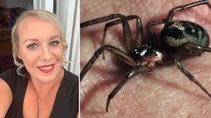 While the black widow's venom is poisonous and can be fatal, many bites result in only minimal most of the time, you can use these basic measures to treat a spider bite at home, on your own False Widow Spider Bite Leaves Barry Woman In Hospital Bbc News
