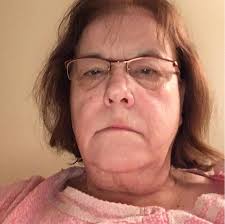 What to do if my dog ate Advil and is pooping blood?