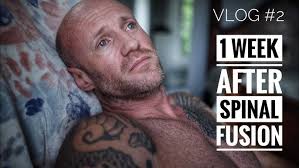 What is a Herniated Disc?