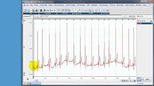 using a macro in labchart to calculate rr intervals and heart rate variability hrv