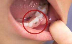 The most recent updates coming out of south africa regarding their travel and entry regulations have indicated that there will be no south africa visa extensions by now, so foreign travelers will have to apply for a new visa if required. Dental Repairs Dental Surgery Orthodontics Walmer Port Elizabeth Dentists At Health