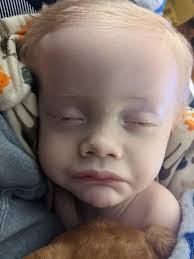 Finley continues to change daily. His little body is beginning to let go.  He went 14 hours without peeing today. He finally peed 15 minutes ago. He  has a fever tonight but