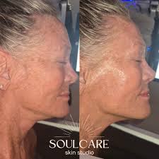 Thank you!! Leah V Skin Care & Laser Clinic Leah Vergara