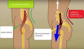 Etirer Psoas 3 Etirements Simples Pour Eviter Douleurs Et Tendinites Il s'agit de muscles liant les lombaires aux cuisses. etirer psoas 3 etirements simples