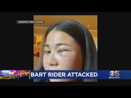 BART ATTACK: Asian woman talks with KPIX 5 about attack