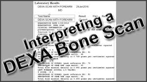 Interpreting A Dexa Bone Scan