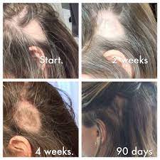 It relies on oils made in its roots to keep it moisturized. Pin By Margie Berrier On My Monat Love This Product Jaymiescroggins Mymonat Com Hairstyles For Thin Hair Hair Treatment Thinning Hair Treatment