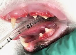 Periodontal Disease