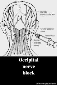 Pin On Neurologie