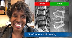 Mayfield Brain & Spine