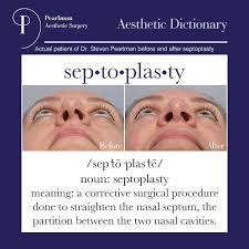 Have You Ever Felt Like One Side If Your Nose Is Always Stuffed Up Or Blocked That May Indicate You Have A Deviate Sleep Apnea Nasal Obstruction Sinus Surgery