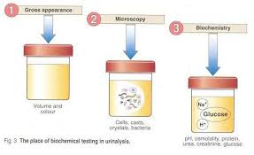 Gross Microscopic Chemical Examination Of Urine Renal Physiology Kidney Disease Kidney