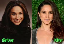 Here's why meghan markle will not be attending the princess diana statue unveiling. Meghan Markle Ungeschminkt Meghan Markle Herzogin Meghan Vollig Isoliert Ist Harrys Frau In Gefahr News De Meghan Duchess Of Sussex Born Rachel Meghan Markle