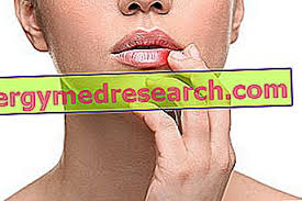 Apakah sistemik lupus eritematosus (sle)? Cheilitis Keradangan Bibir Apa Itu Sebab Gejala Dan Penawar Kesihatan Kulit 2021