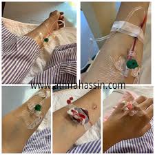 Sebagian ibu menyusui mungkin khawatir untuk mengambil tindakan medis karena mengonsumsi obat tertentu bisa memengaruhi asi. Komplikasi Cabut Gigi Warded Athirahassin