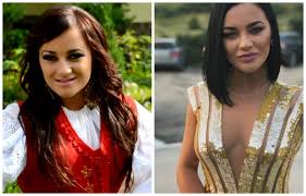 Contact:nekmusic.ro@gmail.com toate drepturile sunt rezervate. Transformare DupÄƒ Transformare Cum ArÄƒta Carmen De La SÄƒlciua Inainte De OperaÈ›iile Estetice