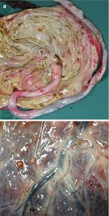 Image result for Chorioamnionitis