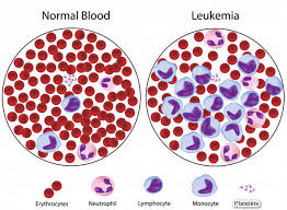 Mpv Blood Test Normal Range Results Interpretation High And Low Laboratoryinfo Com