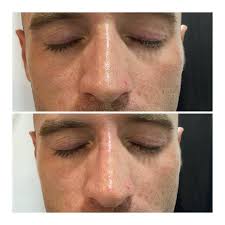 Buen día! Muy contentos con este...